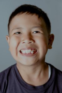 Tulsa Pediatric Dentist | Children's Dental Health Center