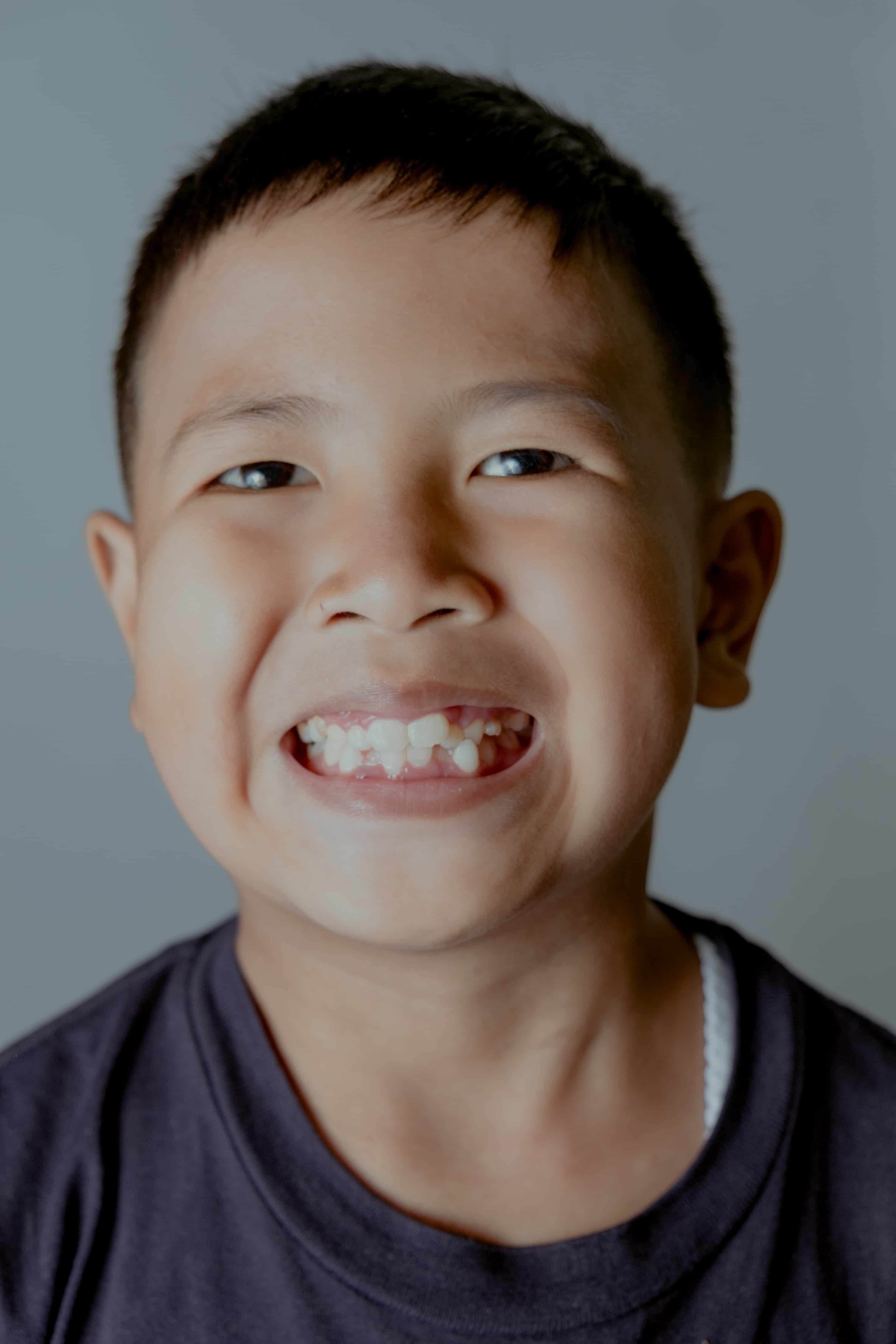 Kids Braces Tulsa | Children's Dental Health Center - Children's Dental